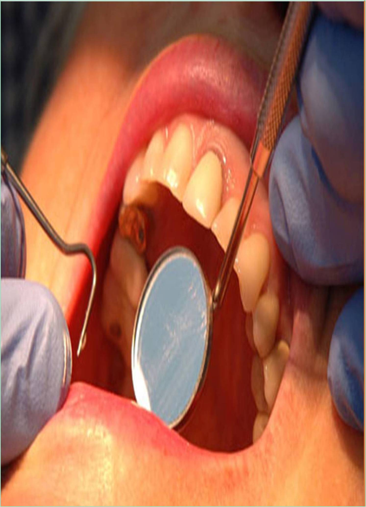 global-journal-of-dentistry-and-oral-hygiene-banner.jpg