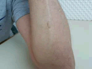 asean-journal-scar