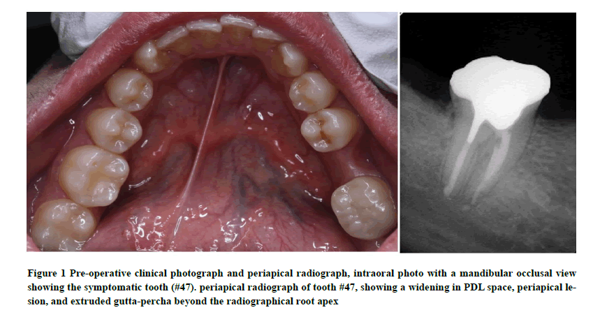 medical-research-health-intraoral-photo