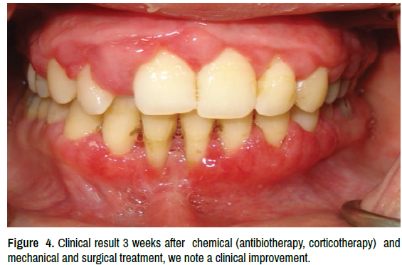 oral-health-case-reports-corticotherapy