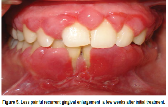 oral-health-case-reports-enlargement
