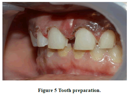 Medical-Health-Tooth