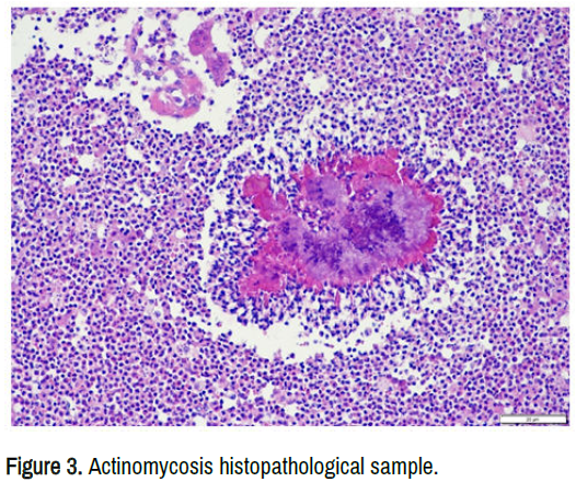 clinical-medical-case-reports-histopathological