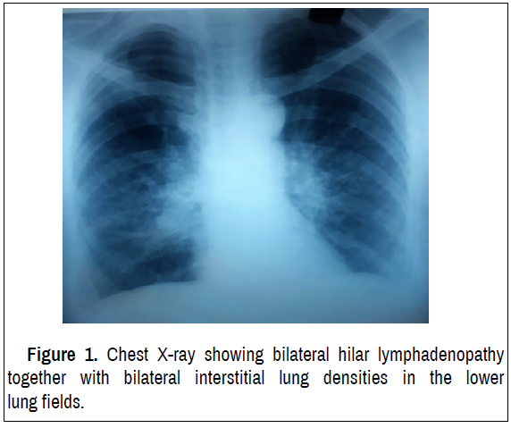 lung-diseases-treatment-lymphadenopathy