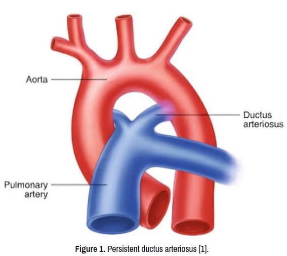vasculitis-arteriosus