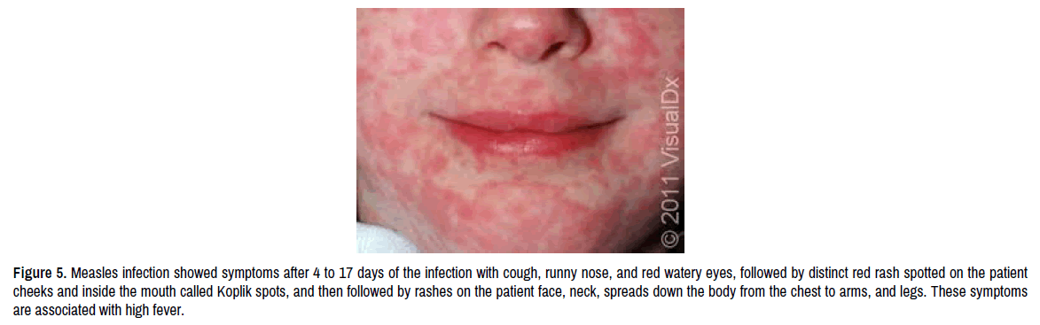 virology-current-research-outer-layer-structure virology-current-research-outer-layer-structure